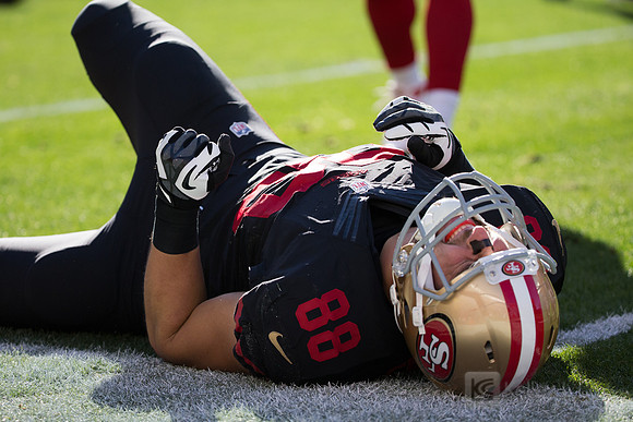 NFL: Arizona Cardinals at San Francisco 49ers